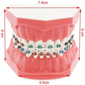 Dentalmall Typodonts Orthodontics Demonstration Model with Metal Wires and Bracket Teaching, Learning, Interpretation Model for Adults and Children (Metal Bracket)