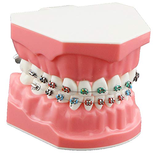 Dentalmall Typodonts Orthodontics Demonstration Model with Metal Wires and Bracket Teaching, Learning, Interpretation Model for Adults and Children (Metal Bracket)