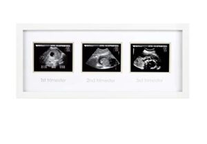pearhead trimester progression sonogram picture frame, pregnancy milestone keepsake photo frame, sonogram keepsake, gender-neutral baby nursery décor
