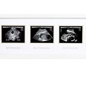 Pearhead Trimester Progression Sonogram Picture Frame, Pregnancy Milestone Keepsake Photo Frame, Sonogram Keepsake, Gender-Neutral Baby Nursery Décor