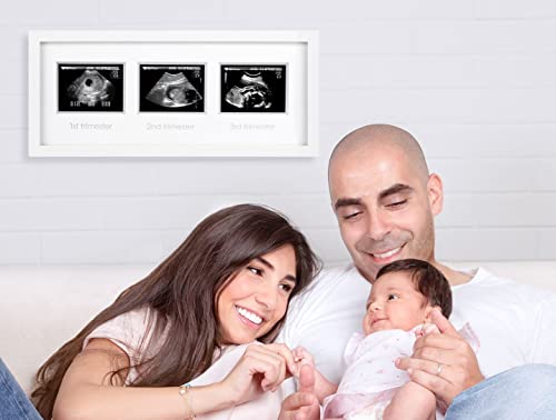 Pearhead Trimester Progression Sonogram Picture Frame, Pregnancy Milestone Keepsake Photo Frame, Sonogram Keepsake, Gender-Neutral Baby Nursery Décor