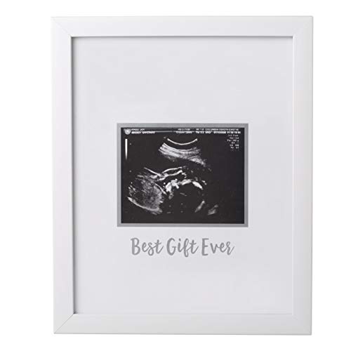 Tiny Ideas Sonogram Signature Frame Guest Book, Perfect for Any Baby Registry, Marker Included for Guests to Leave Well-Wishes, Great for Celebrating Baby Showers or Birthdays, White