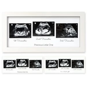sonogram picture frame - trio ultrasound picture frames for mom to be gift - baby ultrasound frame - pregnancy announcements sonogram frame - baby nursery decor, pregnant mom gifts (alpine white)