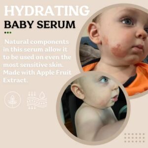 Roe Wellness Baby Children's Serum | All Natural Hydrating Serum For Baby Skin Care, Dry Skin, Moisturizing with Apple Fruit Extract, Daily Probiotics Soothing (Power Serum)