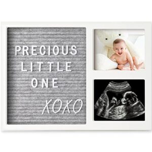 baby picture frame, ultrasound picture frames with felt letterboard - baby photo frame, sonogram picture frame,baby keepsake, sonogram picture frame, baby photo frame, baby shower gifts (alpine white)