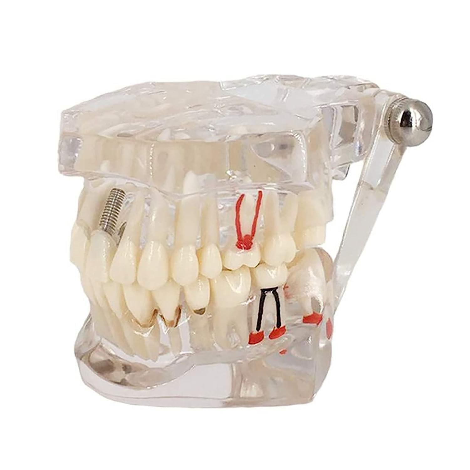 Smedent Dental Study Teaching Teeth Model Adult Typodont Model Removable Tooth