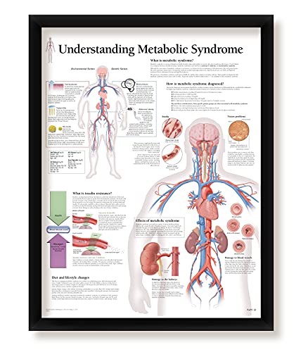 Understanding Metabolic Syndrome Framed Medical Educational Informational Poster Diagram Doctors Office School Classroom 22x28 Inches