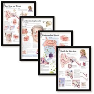 set of 4 framed medical posters ear, nose and throat, understanding sinusitis, understanding rhinitis, and middle ear infections 22"x28" wall diagrams