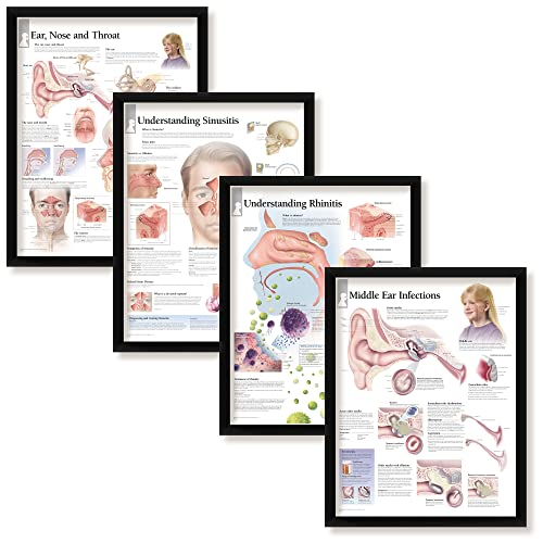 Set of 4 Framed Medical Posters Ear, Nose and Throat, Understanding Sinusitis, Understanding Rhinitis, and Middle Ear Infections 22"x28" Wall Diagrams