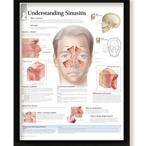 Set of 4 Framed Medical Posters Ear, Nose and Throat, Understanding Sinusitis, Understanding Rhinitis, and Middle Ear Infections 22"x28" Wall Diagrams