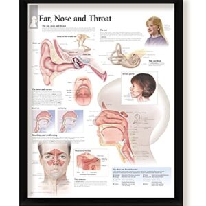 Set of 4 Framed Medical Posters Ear, Nose and Throat, Understanding Sinusitis, Understanding Rhinitis, and Middle Ear Infections 22"x28" Wall Diagrams