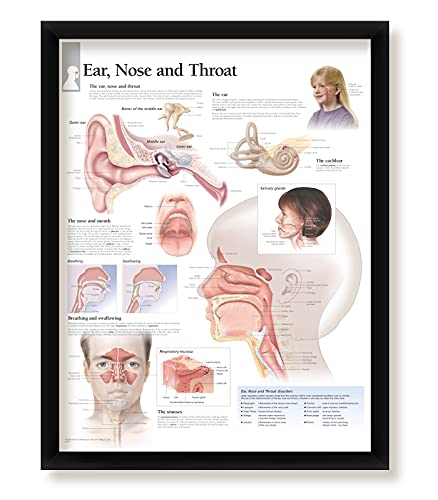 Set of 4 Framed Medical Posters Ear, Nose and Throat, Understanding Sinusitis, Understanding Rhinitis, and Middle Ear Infections 22"x28" Wall Diagrams