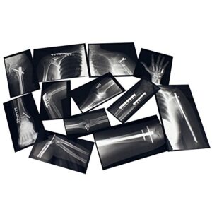 roylco r-59255 fixed bones x-rays, black/white, 14 pieces, model:r59255