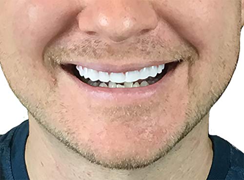 Instant Smile Flex 2pk - Bright White Shade - One Size Fits Most. Fix Your Smile at Home in Minutes! Comfortable Upper Cosmetic Veneer for A Perfect Smile!