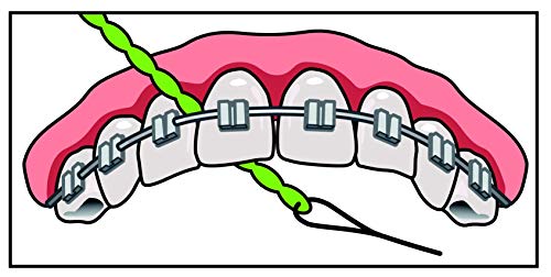 IDontix Brace X-Floss, Green