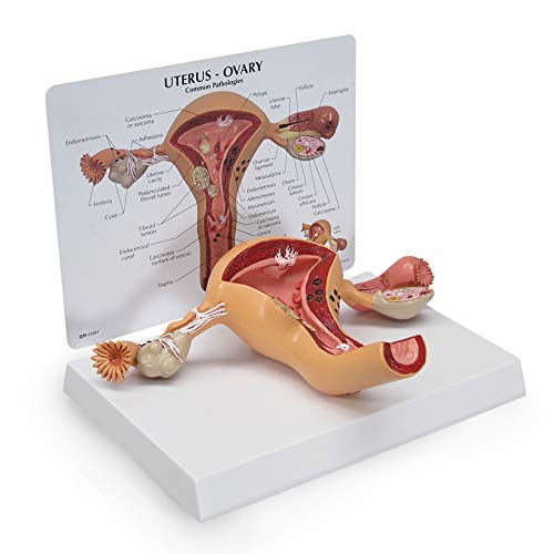 GPI Anatomicals - Uterus and Ovary Model, Model of Female Reproductive System for Human Anatomy and Physiology Education, Anatomy Model for Doctor's Office and Classrooms, Medical Study Supplies