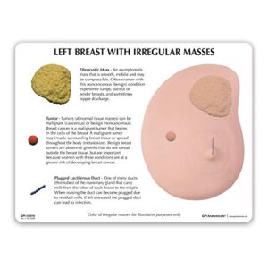 GPI Anatomicals - Human Anatomy Model of Left Breast with Irregular Masses, Replica for Anatomy and Physiology Education, Anatomy Model for Doctor's Office and Classrooms, Medical Study Supplies