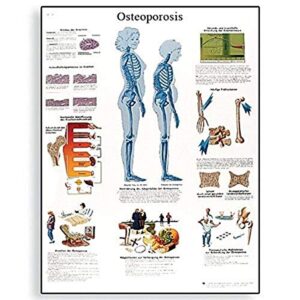 3b scientific vr1121uu glossy paper osteoporosis anatomical chart, poster size 20" width x 26" height