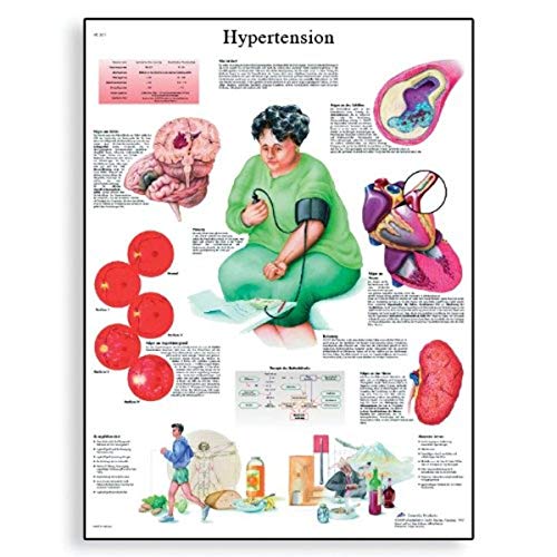 3B Scientific VR1361L Glossy Laminated Paper Hypertension Anatomical Chart, Poster Size 20" Width x 26" Height