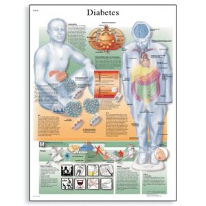 3b scientific vr1441l glossy laminated paper diabetes mellitus anatomical chart, poster size 20" width x 26" height