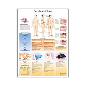 3b scientific vr1717l glossy uv resistant laminated paper decubitus ulcers anatomical chart, poster size 20" width x 26" height