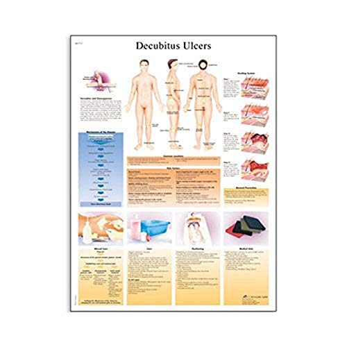 3B Scientific VR1717L Glossy UV Resistant Laminated Paper Decubitus Ulcers Anatomical Chart, Poster Size 20" Width x 26" Height