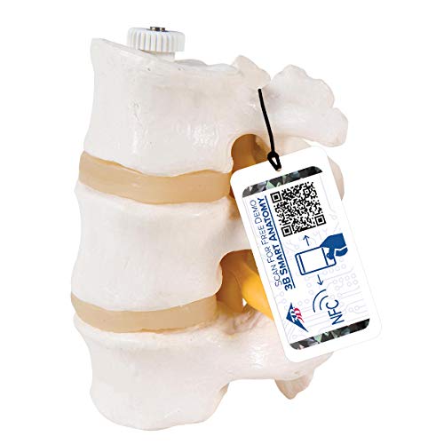 3B Scientific A76/8 3 Lumbar Vertebrae flexibly mounted - 3B Smart Anatomy