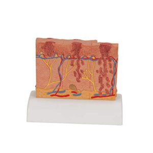 3B Scientific J15 Skin Cancer Model - 3B Smart Anatomy