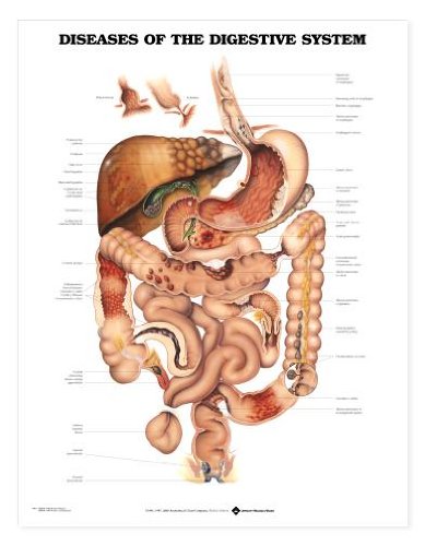 Diseases of the Digestive System Chart