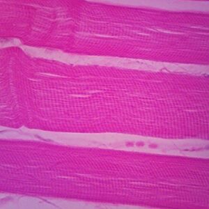 adult human skeletal muscle slide, l.s., 7 m, h&e