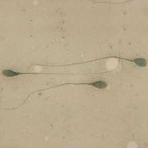 human sperm slide, smear