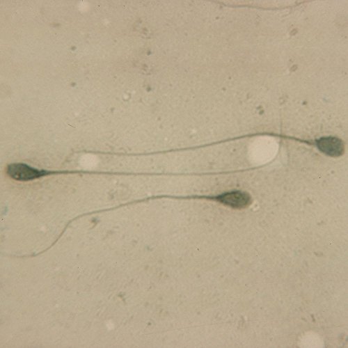 Human Sperm Slide, Smear