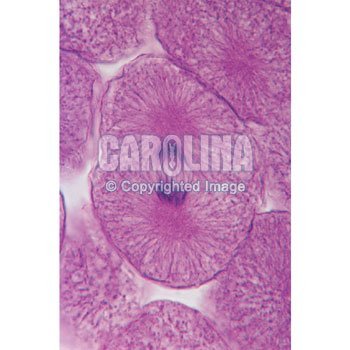 Fish and Onion Mitosis Microscope Slide and Study Guide Set