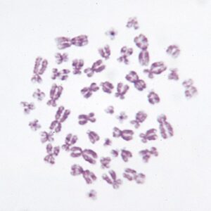 human female chromosomes - 46, xx, spread microscope slide