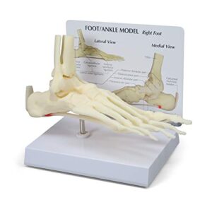 gpi anatomicals - foot & ankle model | human body anatomy replica of foot & ankle w/plantar fasciitis for doctors office educational tool