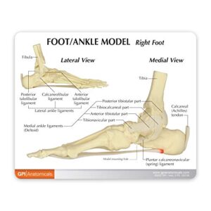 GPI Anatomicals - Foot & Ankle Model | Human Body Anatomy Replica of Foot & Ankle w/Plantar Fasciitis for Doctors Office Educational Tool