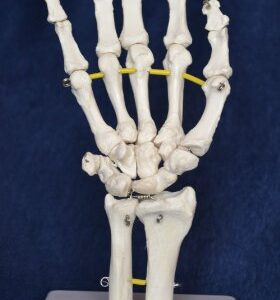 Wellden Product Medical Anatomical Hand Model, Life Size