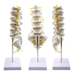 wellden product medical anatomical model lumbar vertebrae w/ sacrum & coccyx, with herniation disc