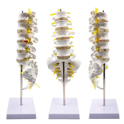 Wellden Product Medical Anatomical Model Lumbar Vertebrae w/ Sacrum & Coccyx, with Herniation Disc
