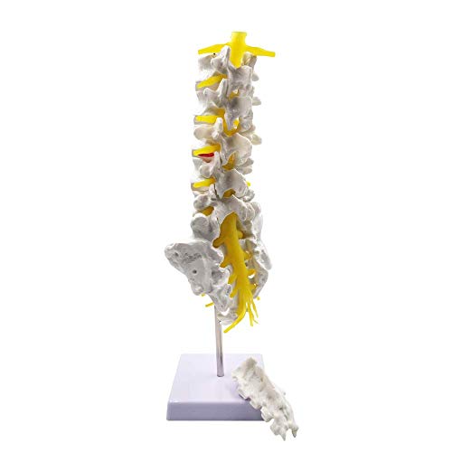 Wellden Product Medical Anatomical Model Lumbar Vertebrae w/ Sacrum & Coccyx, with Herniation Disc