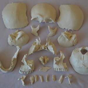 Wellden Medical Anatomical Adult Osteopathic Skull Model, 22-Part, Life Size, Bone Color