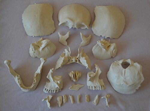 Wellden Medical Anatomical Adult Osteopathic Skull Model, 22-Part, Life Size, Bone Color