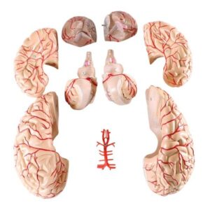 Wellden Medical Anatomical Brain Model, with Arteries, 9 Parts, Life Size
