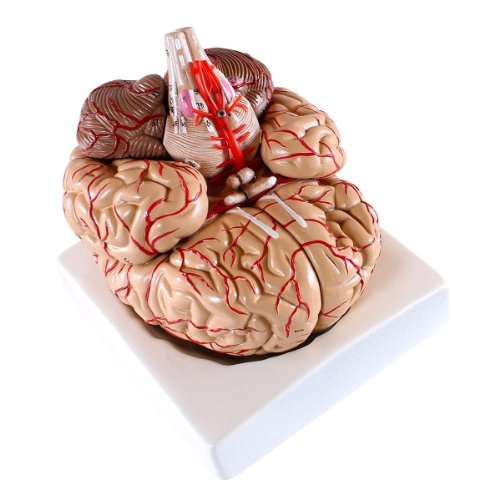 Wellden Medical Anatomical Brain Model, with Arteries, 9 Parts, Life Size