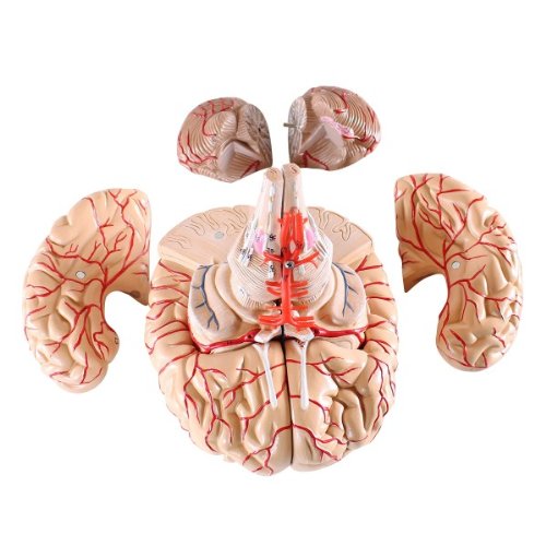Wellden Medical Anatomical Brain Model, with Arteries, 9 Parts, Life Size