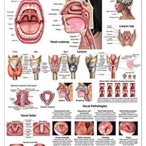 Blue Tree Publishing Larynx LP Poster, voice, education, vocal folds, mouth, head cutview, vocal pathology, size 24Wx36T