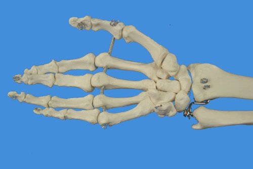 Wellden Product Anatomical Human Right Hand with Ulna and Radius Skeleton Model, Life Size