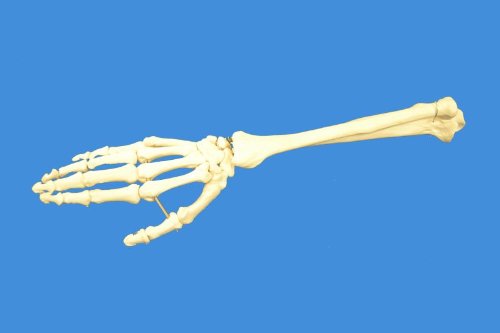 Wellden Product Anatomical Human Right Hand with Ulna and Radius Skeleton Model, Life Size