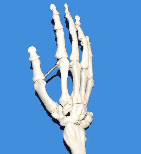 Wellden Product Anatomical Human Upper Limb Skeleton Model, Life Size