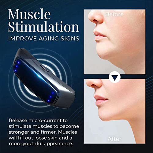 Nubeauty Sleeping V-Face Beauty Device,Sleeping V Face Beauty Device,Nu Beauty Ems Sleeping V Shape,Nubeauty+ Sleeping V-Face Beauty Device (2P)